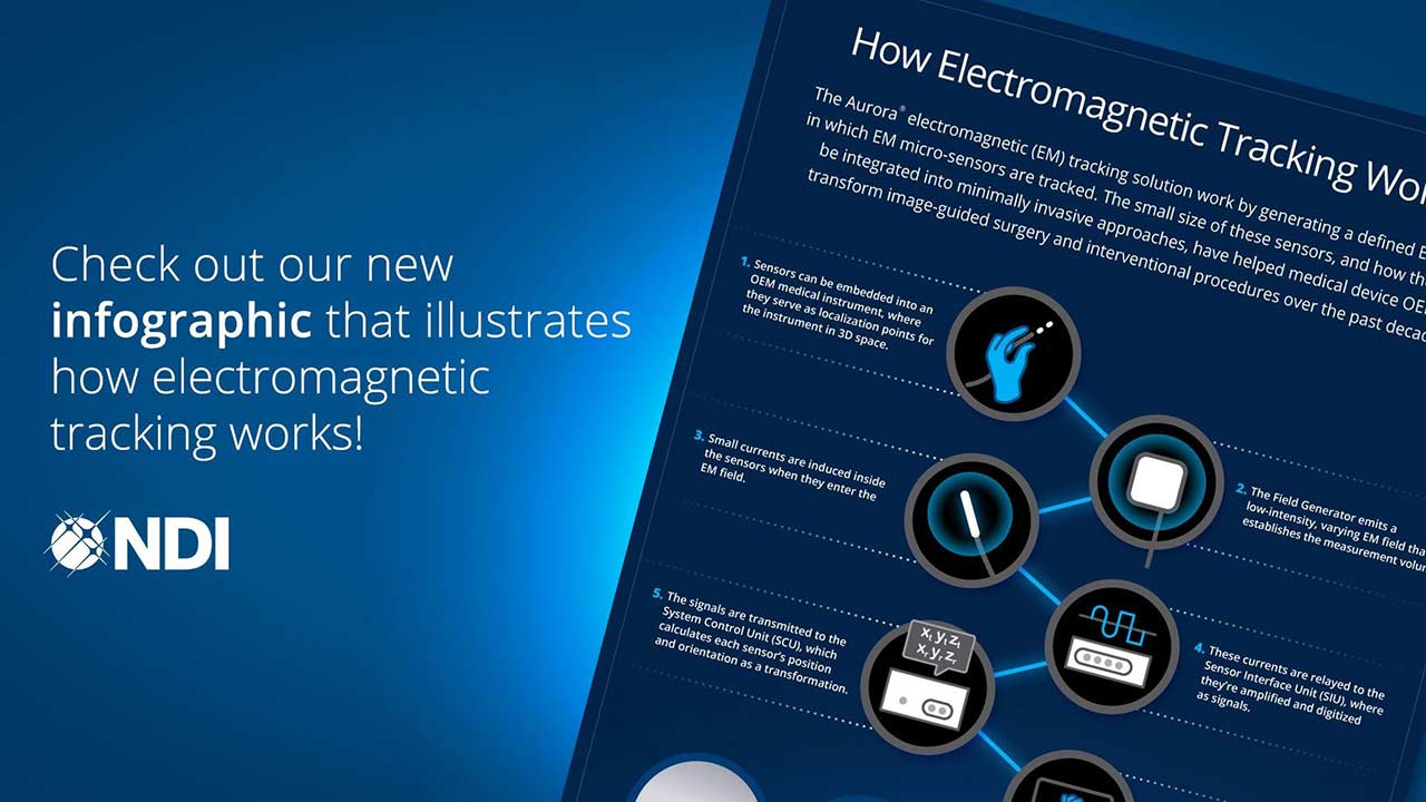 A graphic explaining how electromagnetic tracking works