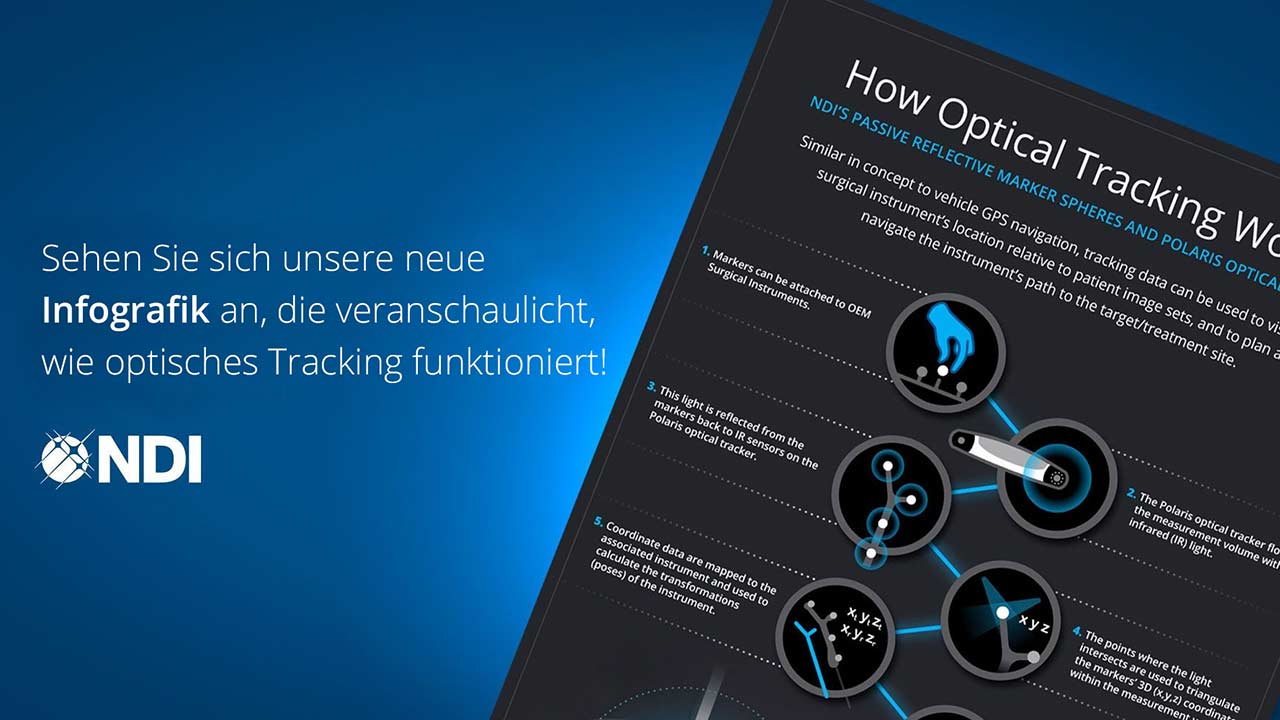 Eine Grafik die erklärt wie optisches Tracking funktioniert